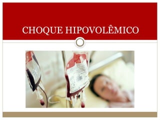 CHOQUE HIPOVOLÊMICO
 