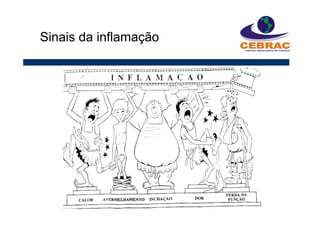 Sinais da inflamação
 