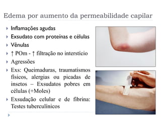 Edema por aumento da permeabilidade capilar
 Inflamações agudas
 Exsudato com proteínas e células
 Vênulas
 ↑ POm - ↑ filtração no interstício
 Agressões
 Exs: Queimaduras, traumatismos
físicos, alergias ou picadas de
insetos – Exsudatos pobres em
células (+Moles)
 Exsudação celular e de fibrina:
Testes tuberculínicos
 