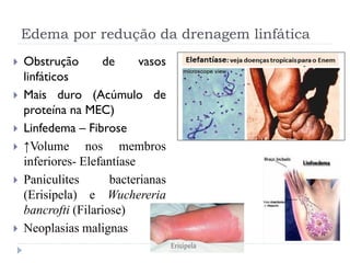 Edema por redução da drenagem linfática
 Obstrução de vasos
linfáticos
 Mais duro (Acúmulo de
proteína na MEC)
 Linfedema – Fibrose
 ↑Volume nos membros
inferiores- Elefantíase
 Paniculites bacterianas
(Erisipela) e Wuchereria
bancrofti (Filariose)
 Neoplasias malignas
 