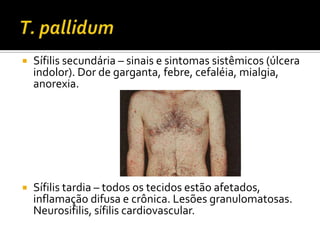 T. pallidumSífilis secundária – sinais e sintomas sistêmicos (úlcera indolor). Dor de garganta, febre, cefaléia, mialgia, anorexia.Sífilis tardia – todos os tecidos estão afetados, inflamação difusa e crônica. Lesões granulomatosas. Neurosifilis, sífilis cardiovascular.