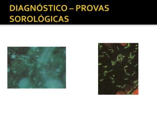 DIAGNÓSTICO – PROVAS SOROLÓGICAS