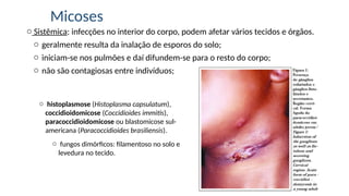 Micoses
o Sistêmica: infecções no interior do corpo, podem afetar vários tecidos e órgãos.
o geralmente resulta da inalação de esporos do solo;
o iniciam-se nos pulmões e daí difundem-se para o resto do corpo;
o não são contagiosas entre indivíduos;
o histoplasmose (Histoplasma capsulatum),
coccidioidomicose (Coccidioides immitis),
paracoccidioidomicose ou blastomicose sul-
americana (Paracoccidioides brasiliensis).
o fungos dimórficos: filamentoso no solo e
levedura no tecido.
 
