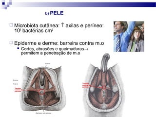 b) PELE
 Microbiota cutânea: ↑ axilas e períneo:
106
bactérias cm2
 Epiderme e derme: barreira contra m.o
 Cortes, abrasões e queimaduras→
permitem a penetração de m.o
 