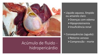 Acúmulo de fluido -
hidropericárdio
• Líquido aquoso, límpido
ou amarelo claro
Doenças com edema
Hipoproteinemia
Insuficiência renal
• Consequências (agudo):
Retorno venoso
Compressão - morte
 
