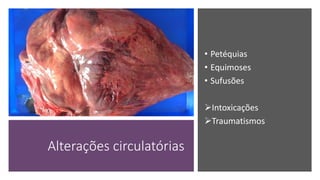 Alterações circulatórias
• Petéquias
• Equimoses
• Sufusões
Intoxicações
Traumatismos
 