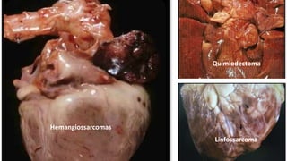 Hemangiossarcomas
Linfossarcoma
Quimiodectoma
 