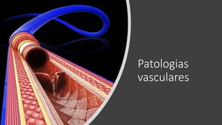 Patologias
vasculares
 