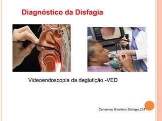 Diagnóstico da Disfagia
Consenso Brasileiro Disfagia,2011
Videoendoscopia da deglutição -VED
 
