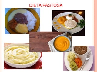 DIETA PASTOSA
 