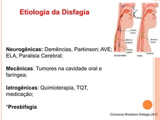 Etiologia da Disfagia
Consenso Brasileiro Disfagia,2011
Neurogênicas: Demências, Parkinson; AVE;
ELA, Paralisia Cerebral;
Mecânicas: Tumores na cavidade oral e
faríngea;
Iatrogênicas: Quimioterapia, TQT,
medicação;
*Presbifagia
 