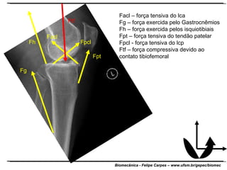 Fg Fh Facl Fpcl Fpt Ftf Facl – força tensiva do lca Fg – força exercida pelo Gastrocnêmios Fh – força exercida pelos isquiotibiais Fpt – força tensiva do tendão patelar Fpcl - força tensiva do lcp Ftf – força compressiva devido ao contato tibiofemoral 