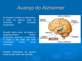 AAvvaannççoo ddoo AAllzzhheeiimmeerr 
O processo começa no hipocampo, 
a parte do cérebro onde as 
memórias são formadas 
inicialmente. 
Durante vários anos, as placas e 
degenerescência fibrilar, 
lentamente, destroem o hipocampo 
e passa a ser cada vez mais 
complicado formar novas 
memórias. 
Simples lembranças de poucas 
horas ou dias atrás vão sumindo. 
 