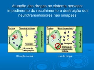 AAttuuaaççããoo ddaass ddrrooggaass nnoo ssiisstteemmaa nneerrvvoossoo:: 
impedimento do recolhimento e destruição dos 
neurotransmissores nas sinapses 
Situação normal Uso de droga 
 