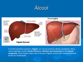 ÁÁllccooooll 
A cirrose acontece quando o fígado, em vez de produzir células saudáveis, bile e 
outros agentes, produz tecido fibroso e nódulos que bloqueiam a circulação 
sanguínea. Esta reação nada mais é do que o fígado produzindo incessantemente 
tecido de cicatrização. 
 