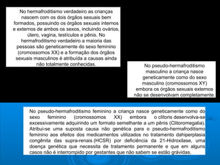 No hermafroditismo verdadeiro as crianças 
nascem com os dois órgãos sexuais bem 
formados, possuindo os órgãos sexuais internos 
e externos de ambos os sexos, incluindo ovários, 
útero, vagina, testículos e pênis. No 
hermafroditismo verdadeiro a maioria das 
pessoas são geneticamente do sexo feminino 
(cromossomos XX) e a formação dos órgãos 
sexuais masculinos é atribuída a causas ainda 
não totalmente conhecidas. No pseudo-hermafroditismo 
masculino a criança nasce 
geneticamente como do sexo 
masculino (cromossomos XY) 
embora os órgãos sexuais externos 
não se desenvolvam completamente. 
No pseudo-hermafroditismo feminino a criança nasce geneticamente como do 
sexo feminino (cromossomos XX) embora o clítoris desenvolva-se 
excessivamente adquirindo um formato semelhante a um pênis (Clitoromegalia). 
Atribui-se uma suposta causa não genética para o pseudo-hermafroditismo 
feminino aos efeitos dos medicamentos utilizados no tratamento dahiperplasia 
congênita das supra-renais (HCSR) por deficiência da 21-Hidroxilase, uma 
doença genética que necessita de tratamento permanente e que em alguns 
casos não é interrompido por gestantes que não sabem se estão grávidas. 
 