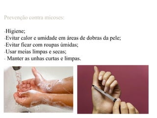 Prevenção contra micoses:
-Higiene;
-Evitar calor e umidade em áreas de dobras da pele;
-Evitar ficar com roupas úmidas;
-Usar meias limpas e secas;
- Manter as unhas curtas e limpas.
 