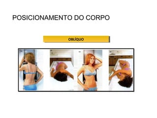 POSICIONAMENTO DO CORPO
OBLÍQUOOBLÍQUO
 