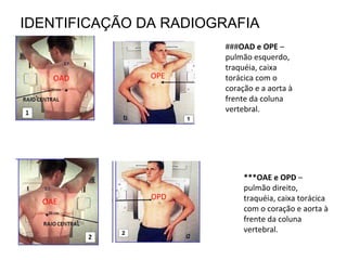 IDENTIFICAÇÃO DA RADIOGRAFIA
***OAE e OPD –
pulmão direito,
traquéia, caixa torácica
com o coração e aorta à
frente da coluna
vertebral.
OAE
OPE
OPD
OAD
###OAD e OPE –
pulmão esquerdo,
traquéia, caixa
torácica com o
coração e a aorta à
frente da coluna
vertebral.
 