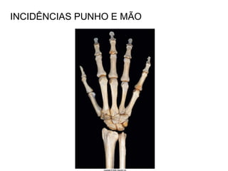 INCIDÊNCIAS PUNHO E MÃO
 