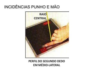 INCIDÊNCIAS PUNHO E MÃO
 