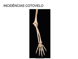 INCIDÊNCIAS COTOVELO
 