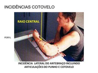 PERFIL
INCIDÊNCIAS COTOVELO
 