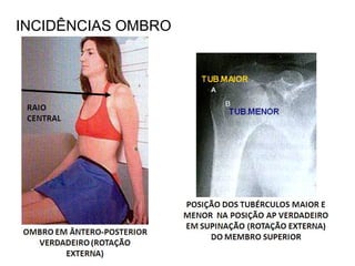 INCIDÊNCIAS OMBRO
 