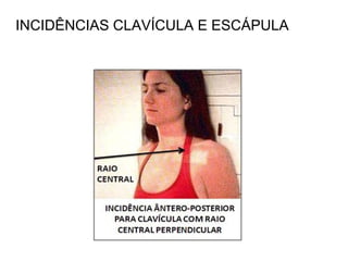 INCIDÊNCIAS CLAVÍCULA E ESCÁPULA
 