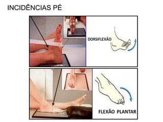 INCIDÊNCIAS PÉ
 
