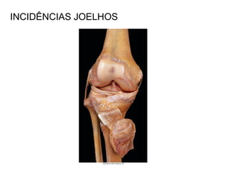 INCIDÊNCIAS JOELHOS
 