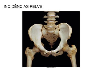 INCIDÊNCIAS PELVE
 