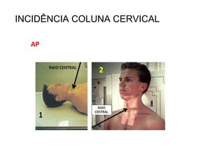 INCIDÊNCIA COLUNA CERVICAL
AP
 