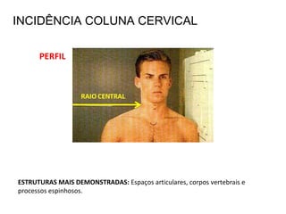 ESTRUTURAS MAIS DEMONSTRADAS: Espaços articulares, corpos vertebrais e
processos espinhosos.
PERFIL
INCIDÊNCIA COLUNA CERVICAL
 