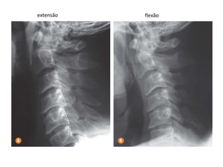 extensão flexão
 