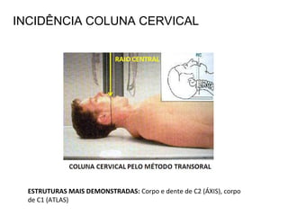 INCIDÊNCIA COLUNA CERVICAL
ESTRUTURAS MAIS DEMONSTRADAS: Corpo e dente de C2 (ÁXIS), corpo
de C1 (ATLAS)
 