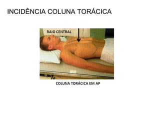 INCIDÊNCIA COLUNA TORÁCICA
 