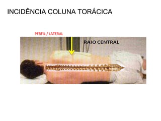 INCIDÊNCIA COLUNA TORÁCICA
PERFIL / LATERAL
 
