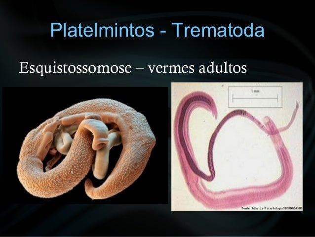 Aula 8 esquistossomose