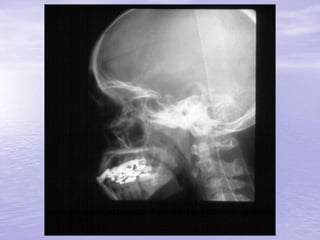 Prof. Fernando Ramos Gonçalves
 