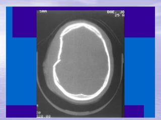 Prof. Fernando Ramos Gonçalves
 