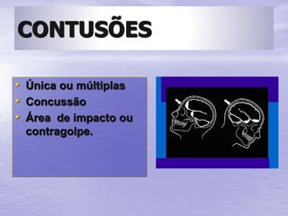CONTUSÕES
• Única ou múltiplas
• Concussão
• Área de impacto ou
contragolpe.
 