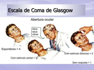 Escala de Coma de Glasgow
 