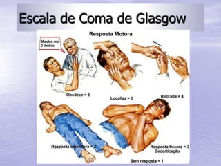 Prof. Fernando Ramos Gonçalves
Escala de Coma de Glasgow
 
