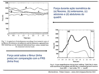 Força durante ação isométrica de (a) flexores, (b) extensores, (c) adutores e (d) abdutores do quadril. Força axial sobre o fêmur (linha preta) em comparação com a FRS (linha fina) 