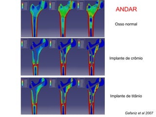 Osso normal Implante de crômio Implante de titânio ANDAR Gafaniz et al 2007 