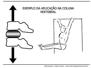 EXEMPLO DA APLICAÇÃO NA COLUNA VERTEBRAL 