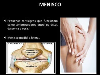 MENISCO
 Pequenas cartilagens que funcionam
como amortecedores entre os ossos
da perna e coxa.
 Menisco medial e lateral.
 