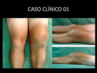 CASO CLÍNICO 01
 