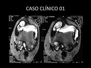 CASO CLÍNICO 01
 